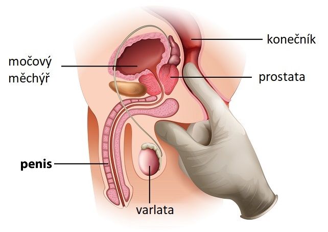 Prostata